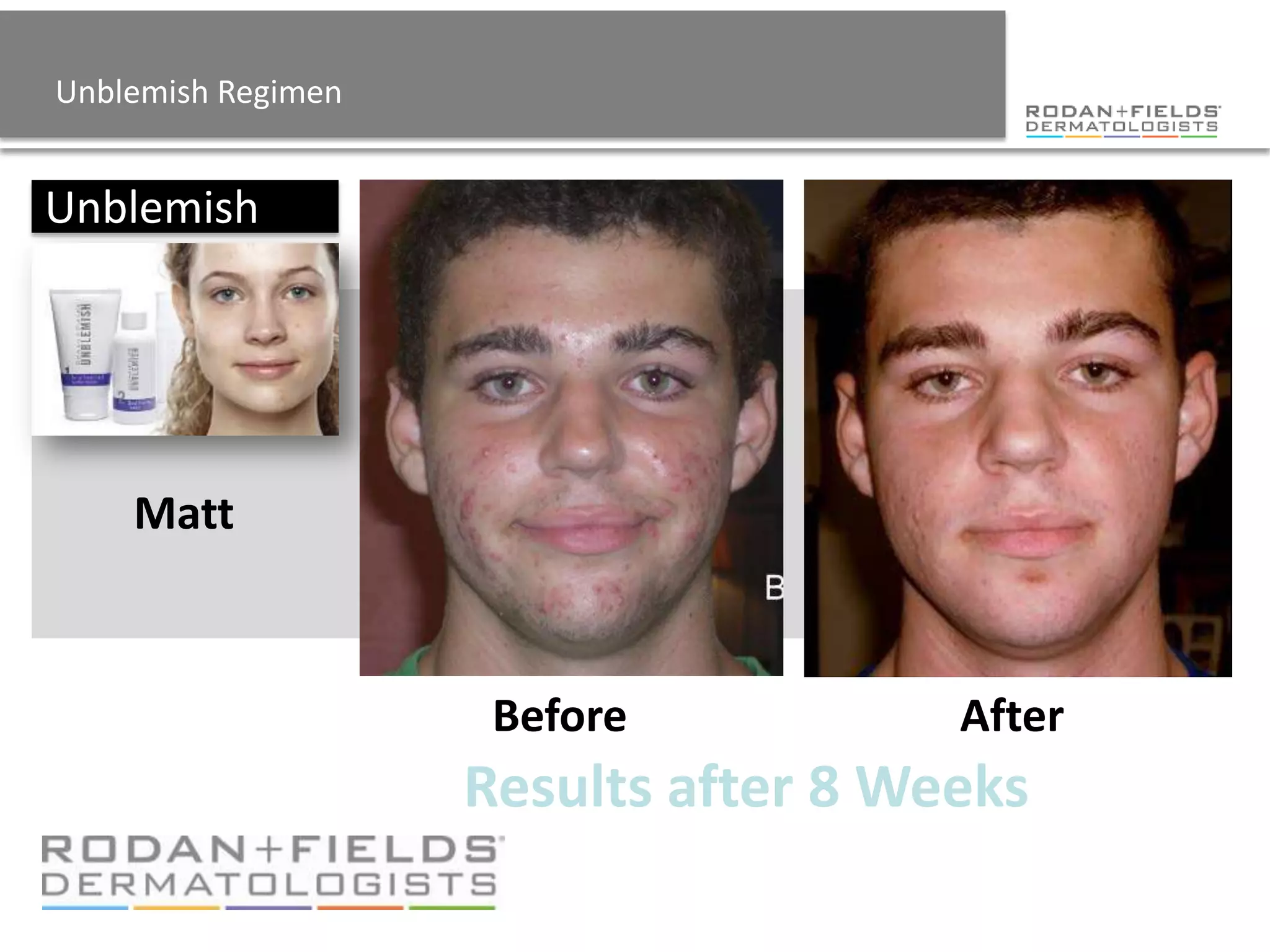 Unblemish Regimen


Unblemish




    Matt



                     Before           After
                    Results after 8 Weeks
 