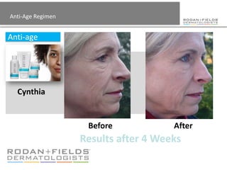 Anti-Age Regimen


Anti-age




  Cynthia


                    Before            After
                   Results after 4 Weeks
 