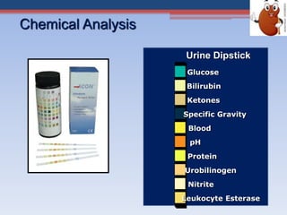 Chemical Analysis
Urine Dipstick
Glucose
Bilirubin
Ketones
Specific Gravity
Blood
pH
Protein
Urobilinogen
Nitrite
Leukocyte Esterase
 