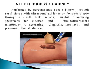 Performed by percutaneous needle biopsy through
renal tissue with ultrasound guidance or by open biopsy
through a small flank incision; useful in securing
specimens for electron and immunofluorescent
microscopy to determine diagnosis, treatment, and
prognosis of renal disease.
 