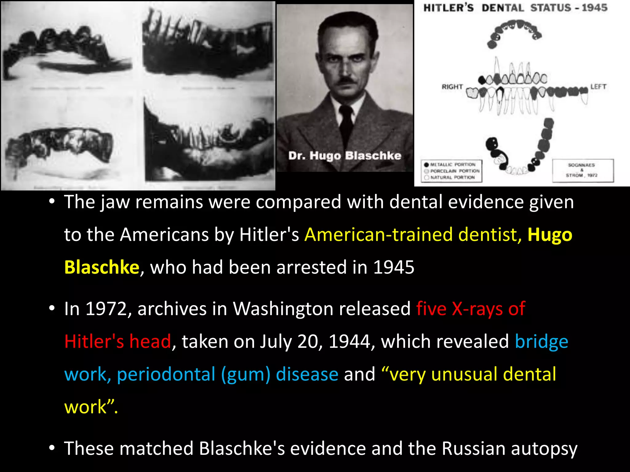 • The jaw remains were compared with dental evidence given
to the Americans by Hitler's American-trained dentist, Hugo
Blaschke, who had been arrested in 1945
• In 1972, archives in Washington released five X-rays of
Hitler's head, taken on July 20, 1944, which revealed bridge
work, periodontal (gum) disease and “very unusual dental
work”.
• These matched Blaschke's evidence and the Russian autopsy
 
