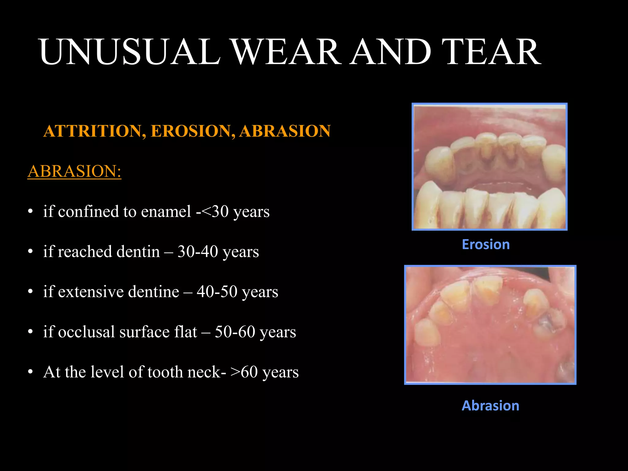 UNUSUAL WEAR AND TEAR
ATTRITION, EROSION, ABRASION
ABRASION:
• if confined to enamel -<30 years
• if reached dentin – 30-40 years
• if extensive dentine – 40-50 years
• if occlusal surface flat – 50-60 years
• At the level of tooth neck- >60 years
Erosion
Abrasion
 