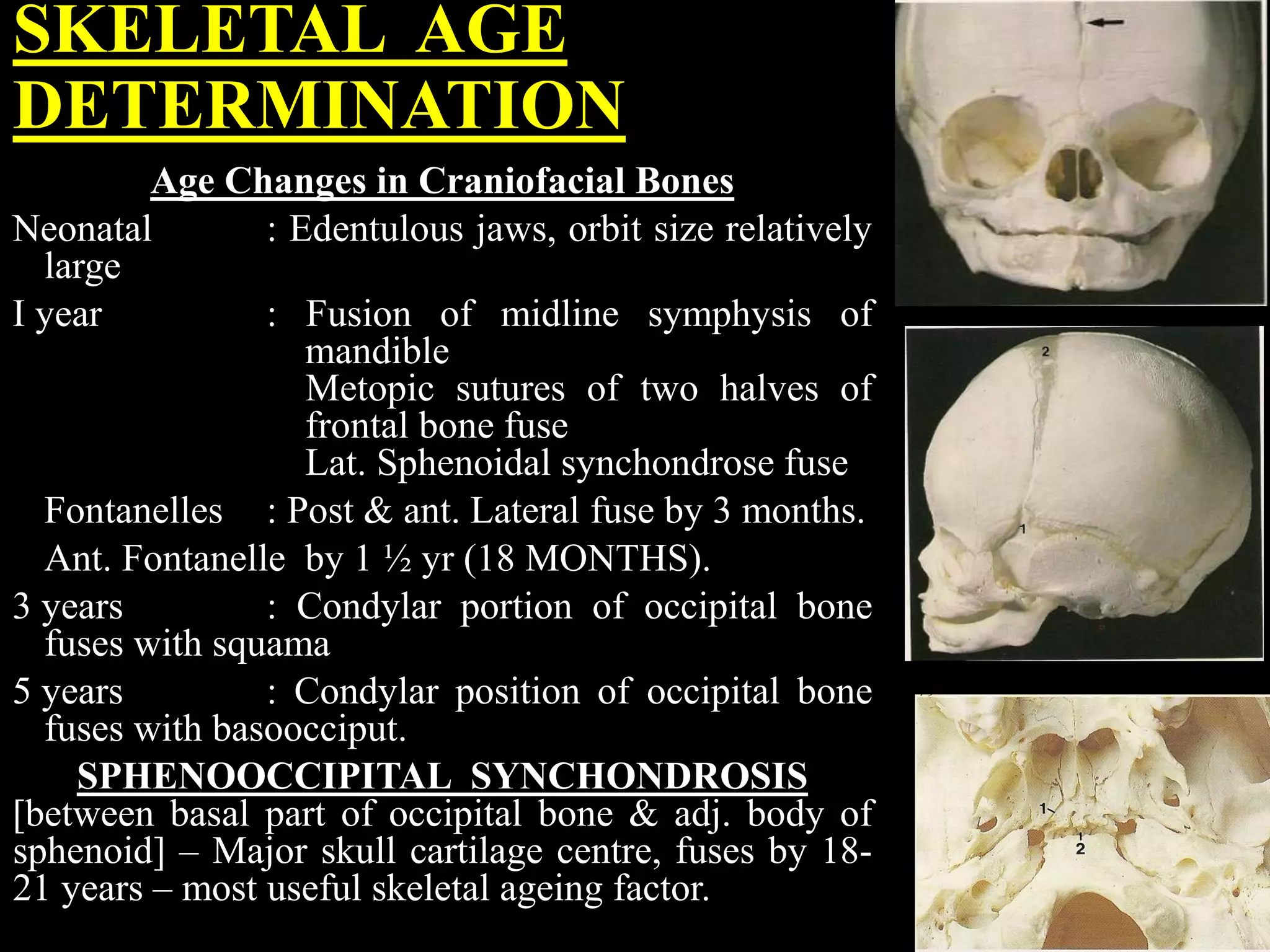 SKELETAL AGE
DETERMINATION
Age Changes in Craniofacial Bones
Neonatal : Edentulous jaws, orbit size relatively
large
I year : Fusion of midline symphysis of
mandible
Metopic sutures of two halves of
frontal bone fuse
Lat. Sphenoidal synchondrose fuse
Fontanelles : Post & ant. Lateral fuse by 3 months.
Ant. Fontanelle by 1 ½ yr (18 MONTHS).
3 years : Condylar portion of occipital bone
fuses with squama
5 years : Condylar position of occipital bone
fuses with basoocciput.
SPHENOOCCIPITAL SYNCHONDROSIS
[between basal part of occipital bone & adj. body of
sphenoid] – Major skull cartilage centre, fuses by 18-
21 years – most useful skeletal ageing factor.
 