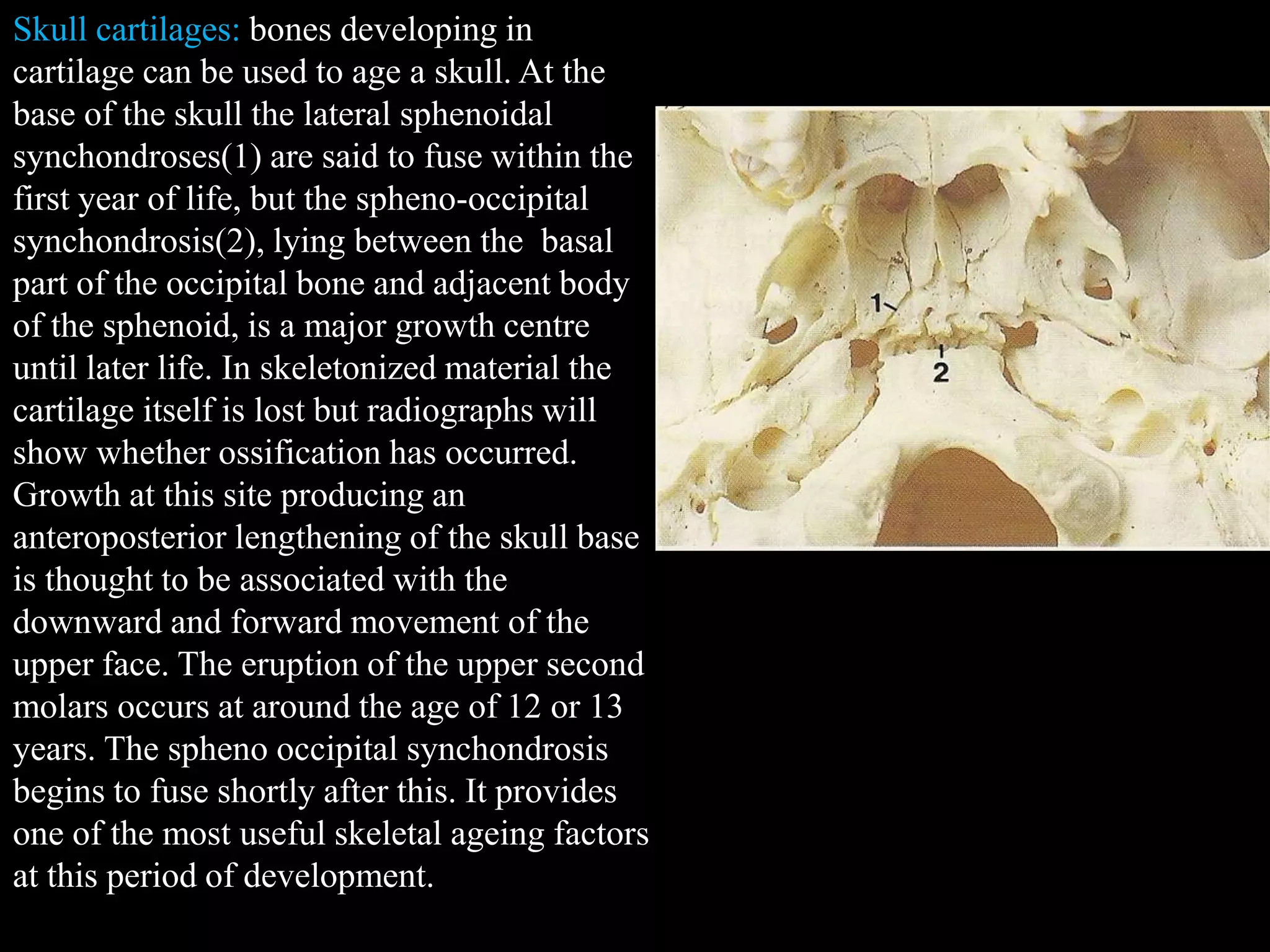 Skull cartilages: bones developing in
cartilage can be used to age a skull. At the
base of the skull the lateral sphenoidal
synchondroses(1) are said to fuse within the
first year of life, but the spheno-occipital
synchondrosis(2), lying between the basal
part of the occipital bone and adjacent body
of the sphenoid, is a major growth centre
until later life. In skeletonized material the
cartilage itself is lost but radiographs will
show whether ossification has occurred.
Growth at this site producing an
anteroposterior lengthening of the skull base
is thought to be associated with the
downward and forward movement of the
upper face. The eruption of the upper second
molars occurs at around the age of 12 or 13
years. The spheno occipital synchondrosis
begins to fuse shortly after this. It provides
one of the most useful skeletal ageing factors
at this period of development.
 
