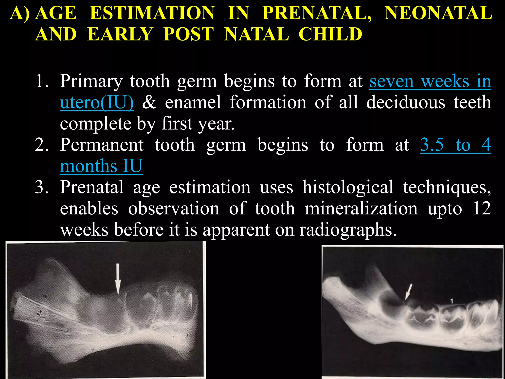 A) AGE ESTIMATION IN PRENATAL, NEONATAL
AND EARLY POST NATAL CHILD
1. Primary tooth germ begins to form at seven weeks in
utero(IU) & enamel formation of all deciduous teeth
complete by first year.
2. Permanent tooth germ begins to form at 3.5 to 4
months IU
3. Prenatal age estimation uses histological techniques,
enables observation of tooth mineralization upto 12
weeks before it is apparent on radiographs.
 