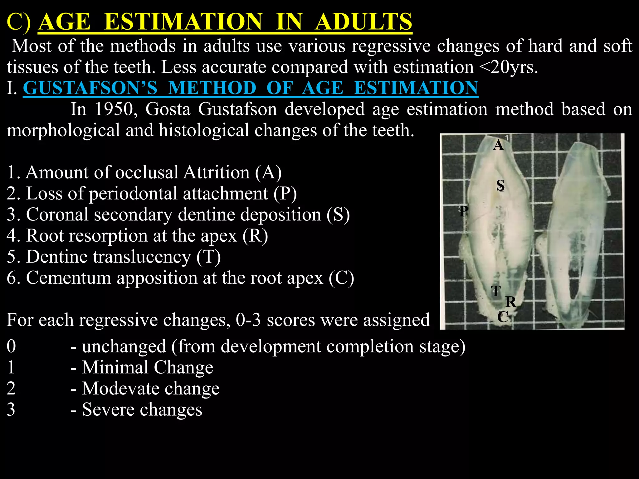 C) AGE ESTIMATION IN ADULTS
Most of the methods in adults use various regressive changes of hard and soft
tissues of the teeth. Less accurate compared with estimation <20yrs.
I. GUSTAFSON’S METHOD OF AGE ESTIMATION
In 1950, Gosta Gustafson developed age estimation method based on
morphological and histological changes of the teeth.
1. Amount of occlusal Attrition (A)
2. Loss of periodontal attachment (P)
3. Coronal secondary dentine deposition (S)
4. Root resorption at the apex (R)
5. Dentine translucency (T)
6. Cementum apposition at the root apex (C)
For each regressive changes, 0-3 scores were assigned
0 - unchanged (from development completion stage)
1 - Minimal Change
2 - Modevate change
3 - Severe changes
A
P
S
R
T
C
 