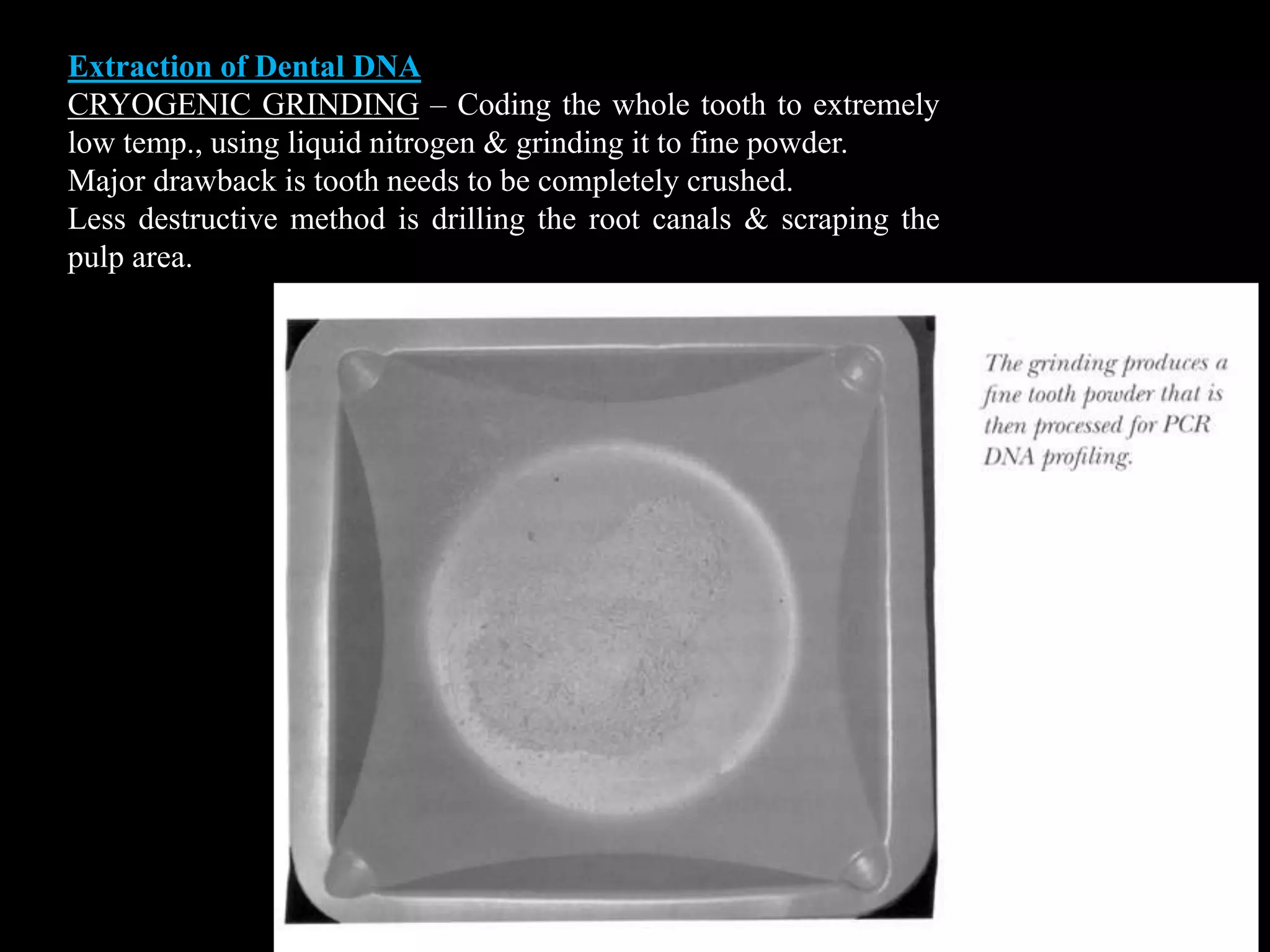 Extraction of Dental DNA
CRYOGENIC GRINDING – Coding the whole tooth to extremely
low temp., using liquid nitrogen & grinding it to fine powder.
Major drawback is tooth needs to be completely crushed.
Less destructive method is drilling the root canals & scraping the
pulp area.
 