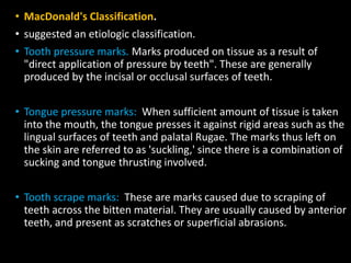 • MacDonald's Classification.
• suggested an etiologic classification.
• Tooth pressure marks. Marks produced on tissue as a result of
"direct application of pressure by teeth". These are generally
produced by the incisal or occlusal surfaces of teeth.
• Tongue pressure marks: When sufficient amount of tissue is taken
into the mouth, the tongue presses it against rigid areas such as the
lingual surfaces of teeth and palatal Rugae. The marks thus left on
the skin are referred to as 'suckling,' since there is a combination of
sucking and tongue thrusting involved.
• Tooth scrape marks: These are marks caused due to scraping of
teeth across the bitten material. They are usually caused by anterior
teeth, and present as scratches or superficial abrasions.
 