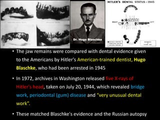 • The jaw remains were compared with dental evidence given
to the Americans by Hitler's American-trained dentist, Hugo
Blaschke, who had been arrested in 1945
• In 1972, archives in Washington released five X-rays of
Hitler's head, taken on July 20, 1944, which revealed bridge
work, periodontal (gum) disease and “very unusual dental
work”.
• These matched Blaschke's evidence and the Russian autopsy
 
