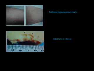 Tooth and tongue pressure marks
Bite marks on cheese
 