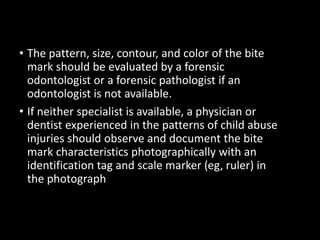 • The pattern, size, contour, and color of the bite
mark should be evaluated by a forensic
odontologist or a forensic pathologist if an
odontologist is not available.
• If neither specialist is available, a physician or
dentist experienced in the patterns of child abuse
injuries should observe and document the bite
mark characteristics photographically with an
identification tag and scale marker (eg, ruler) in
the photograph
 