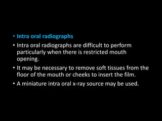 • Intra oral radiographs
• Intra oral radiographs are difficult to perform
particularly when there is restricted mouth
opening.
• It may be necessary to remove soft tissues from the
floor of the mouth or cheeks to insert the film.
• A miniature intra oral x-ray source may be used.
 