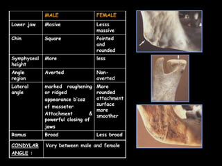MALE FEMALE
Lower jaw Masive Lesss
massive
Chin Square Pointed
and
rounded
Symphyseal
height
More less
Angle
region
Averted Non-
averted
Lateral
angle
marked roughening
or ridged
appearance b’coz
of masseter
Attachment &
powerful closing of
jaws
More
rounded
attachment
surface
more
smoother
Ramus Broad Less broad
CONDYLAR
ANGLE :
Vary between male and female
 