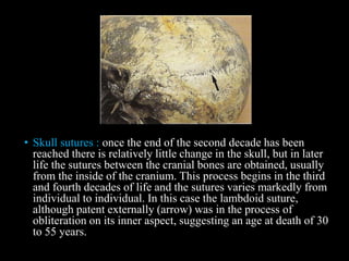 • Skull sutures : once the end of the second decade has been
reached there is relatively little change in the skull, but in later
life the sutures between the cranial bones are obtained, usually
from the inside of the cranium. This process begins in the third
and fourth decades of life and the sutures varies markedly from
individual to individual. In this case the lambdoid suture,
although patent externally (arrow) was in the process of
obliteration on its inner aspect, suggesting an age at death of 30
to 55 years.
 