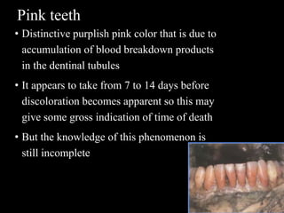 Pink teeth
• Distinctive purplish pink color that is due to
accumulation of blood breakdown products
in the dentinal tubules
• It appears to take from 7 to 14 days before
discoloration becomes apparent so this may
give some gross indication of time of death
• But the knowledge of this phenomenon is
still incomplete
 