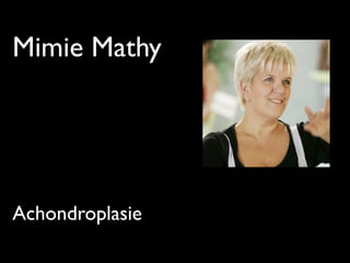 Mimie Mathy
Achondroplasie
 