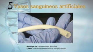 Vasos sanguíneos artificiales
Investigación: Universidad de Hokkaido.
Estado: Probándose en humanos en ensayos clínicos.
 