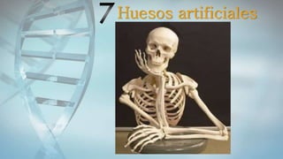 Huesos artificiales
 