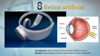 Retina artificial
Investigación: Mark Humayun, Universidad de California del Sur.
Estado: Desarrollada con éxito, esperando su comercialización.
 