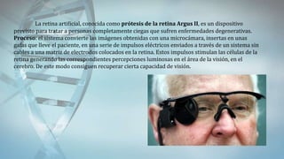 La retina artificial, conocida como prótesis de la retina Argus II, es un dispositivo
previsto para tratar a personas completamente ciegas que sufren enfermedades degenerativas.
Proceso: el sistema convierte las imágenes obtenidas con una microcámara, insertas en unas
gafas que lleve el paciente, en una serie de impulsos eléctricos enviados a través de un sistema sin
cables a una matriz de electrodos colocados en la retina. Estos impulsos stimulan las células de la
retina generando las correspondientes percepciones luminosas en el área de la visión, en el
cerebro. De este modo consiguen recuperar cierta capacidad de visión.
 
