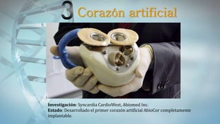 Investigación: Syncardia CardioWest, Abiomed Inc.
Estado: Desarrollado el primer corazón artificial AbioCor completamente
implantable.
Corazón artificial
 