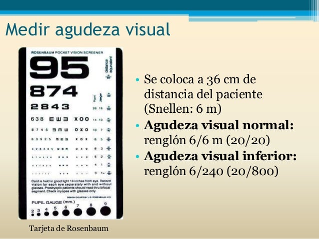 Fotosensibilidad ocular y dolor de cabeza Fotosensibilidad ocular y dolor de cabeza