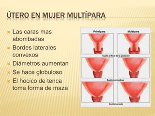 ÚTERO EN MUJER MULTÍPARA
 Las caras mas
abombadas
 Bordes laterales
convexos
 Diámetros aumentan
 Se hace globuloso
 El hocico de tenca
toma forma de maza
 