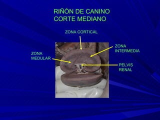 ORganos urinarios | PPT