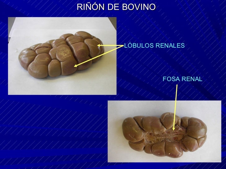 ORganos urinarios