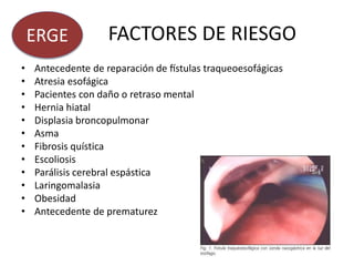 FACTORES DE RIESGO
• Antecedente de reparación de fístulas traqueoesofágicas
• Atresia esofágica
• Pacientes con daño o retraso mental
• Hernia hiatal
• Displasia broncopulmonar
• Asma
• Fibrosis quística
• Escoliosis
• Parálisis cerebral espástica
• Laringomalasia
• Obesidad
• Antecedente de prematurez
ERGE
 