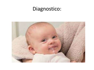 Diagnostico:
 