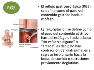 • El reflujo gastroesofágico (RGE)
se define como el paso del
contenido gástrico hacia el
esófago.
• La regurgitación se define como
el paso del contenido gástrico
hacia el esófago o hacia la boca
“sin esfuerzo alguno” o
“arcada”, es decir, no hay
contracción del diafragma; es el
regreso involuntario hacia la
boca, de comida o secreciones
previamente deglutidas.
RGE
 