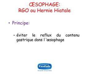 OESOPHAGE: RGO ou Hernie Hiatale 
•Principe: 
Ŕéviterlerefluxducontenugastriquedansl’oesophage  