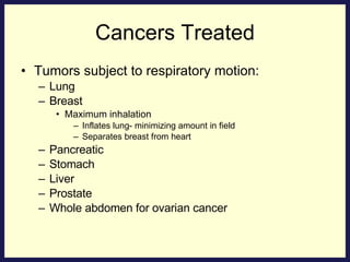 Cancers Treated Tumors subject to respiratory motion: Lung Breast Maximum inhalation Inflates lung- minimizing amount in field Separates breast from heart Pancreatic Stomach Liver Prostate Whole abdomen for ovarian cancer 