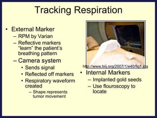 Tracking Respiration External Marker RPM by Varian Reflective markers “learn” the patient’s breathing pattern Camera system Sends signal  Reflected off markers Respiratory waveform created Shape represents tumor movement Internal Markers Implanted gold seeds Use flouroscopy to locate http://www.biij.org/2007/1/e40/fig1.jpg 