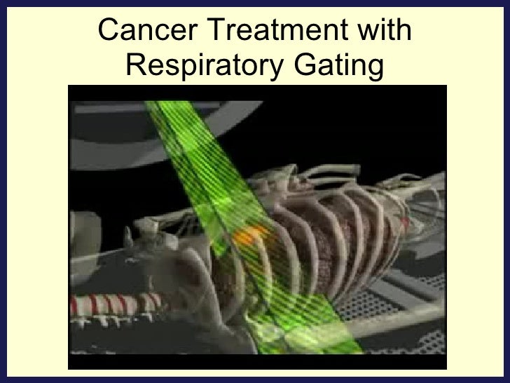 The Role Of Image Guidance In Respiratory Gated Radiotherapy – BQCL