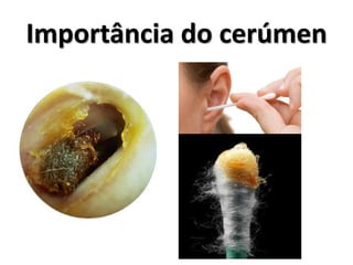 Importância do cerúmen
 