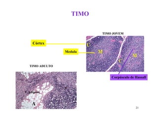 TIMO

                           TIMO JOVEM


     Córtex

                 Medula


   TIMO ADULTO


                               Corpúsculo de Hassall



T. Adiposo



                                             21
 
