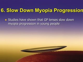 fitting RGP lenses | PPT