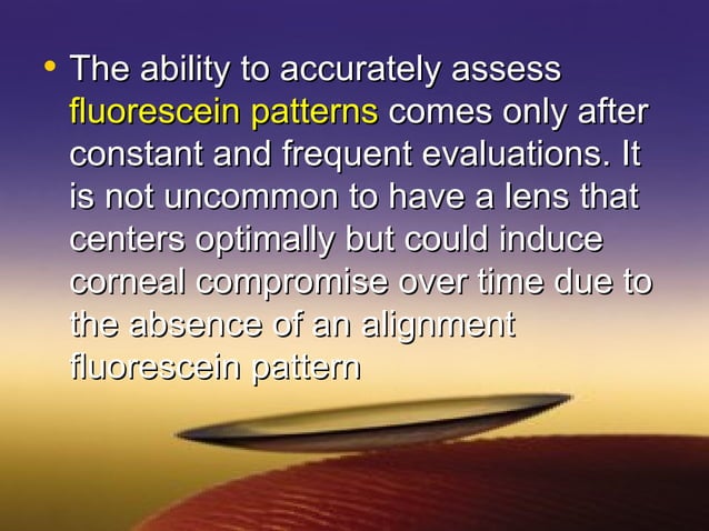 fitting RGP lenses | PPT