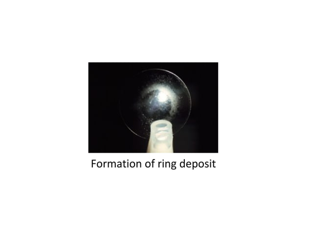 RGP lens care and maintenance | PPT | Eye and Vision Conditions ...