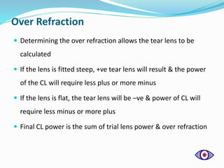 Over Refraction
 Determining the over refraction allows the tear lens to be
calculated
 If the lens is fitted steep, +ve tear lens will result & the power
of the CL will require less plus or more minus
 If the lens is flat, the tear lens will be –ve & power of CL will
require less minus or more plus
 Final CL power is the sum of trial lens power & over refraction
 
