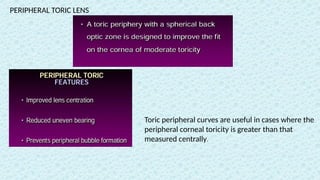 PERIPHERAL TORIC LENS
Toric peripheral curves are useful in cases where the
peripheral corneal toricity is greater than that
measured centrally.
 