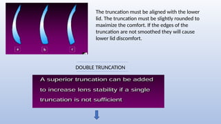 The truncation must be aligned with the lower
lid. The truncation must be slightly rounded to
maximize the comfort. If the edges of the
truncation are not smoothed they will cause
lower lid discomfort.
DOUBLE TRUNCATION
 