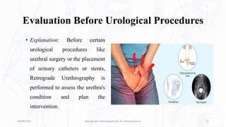 Evaluation Before Urological Procedures
• Explanation: Before certain
urological procedures like
urethral surgery or the placement
of urinary catheters or stents,
Retrograde Urethrography is
performed to assess the urethra's
condition and plan the
intervention.
18/08/2023 Retrograde Urethrography By- Dr. Dheeraj Kumar 11
 