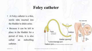 Foley catheter
• A Foley catheter is a thin,
sterile tube inserted into
the bladder to drain urine.
• Because it can be left in
place in the bladder for a
period of time, it is also
called an indwelling
catheter.
18/08/2023 Retrograde Urethrography By- Dr. Dheeraj Kumar 13
 