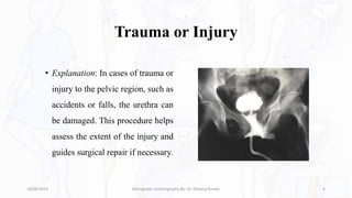 Trauma or Injury
• Explanation: In cases of trauma or
injury to the pelvic region, such as
accidents or falls, the urethra can
be damaged. This procedure helps
assess the extent of the injury and
guides surgical repair if necessary.
18/08/2023 Retrograde Urethrography By- Dr. Dheeraj Kumar 6
 
