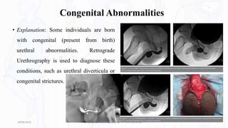 Congenital Abnormalities
• Explanation: Some individuals are born
with congenital (present from birth)
urethral abnormalities. Retrograde
Urethrography is used to diagnose these
conditions, such as urethral diverticula or
congenital strictures.
18/08/2023 Retrograde Urethrography By- Dr. Dheeraj Kumar 7
 