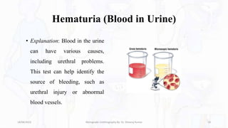 Hematuria (Blood in Urine)
• Explanation: Blood in the urine
can have various causes,
including urethral problems.
This test can help identify the
source of bleeding, such as
urethral injury or abnormal
blood vessels.
18/08/2023 Retrograde Urethrography By- Dr. Dheeraj Kumar 10
 