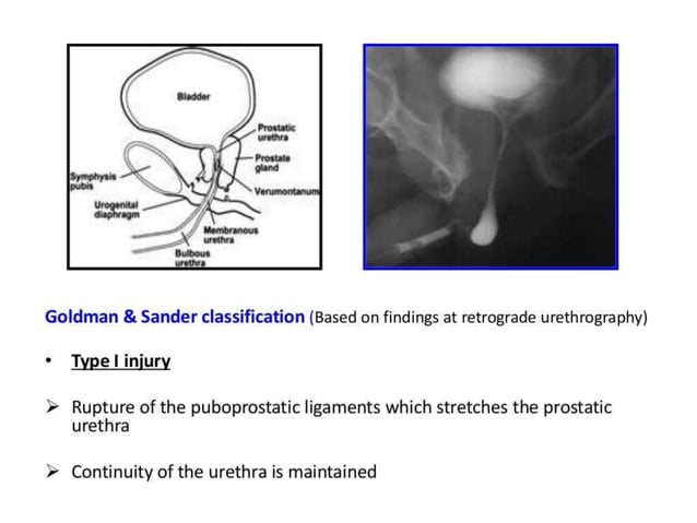 retrograde urethrogram for urology residents | PPTX
